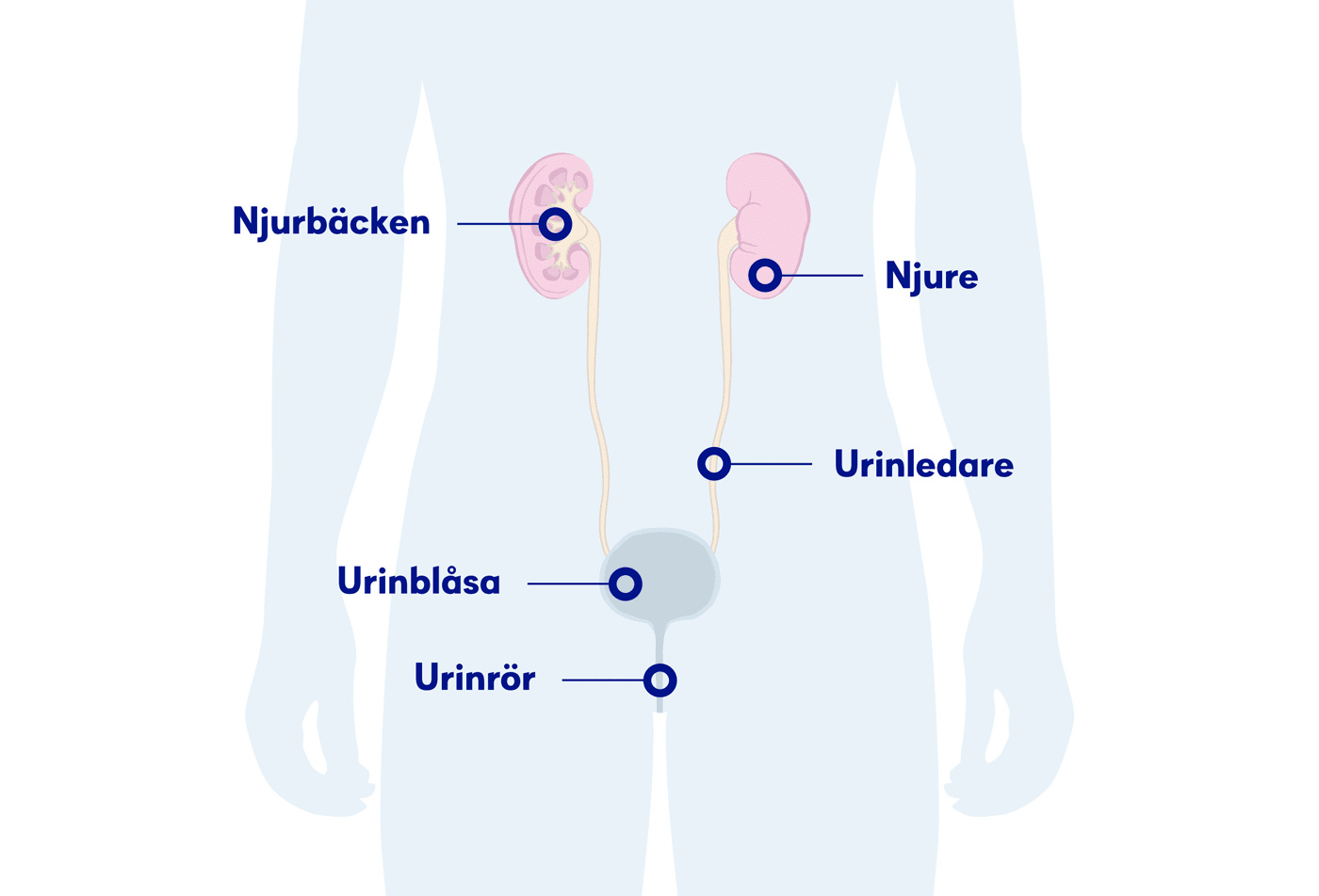 Illustration njurarna, njurcancer