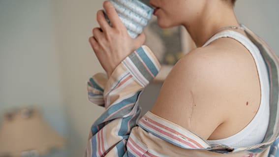 överarm med ett 5-7 cm långt ärr